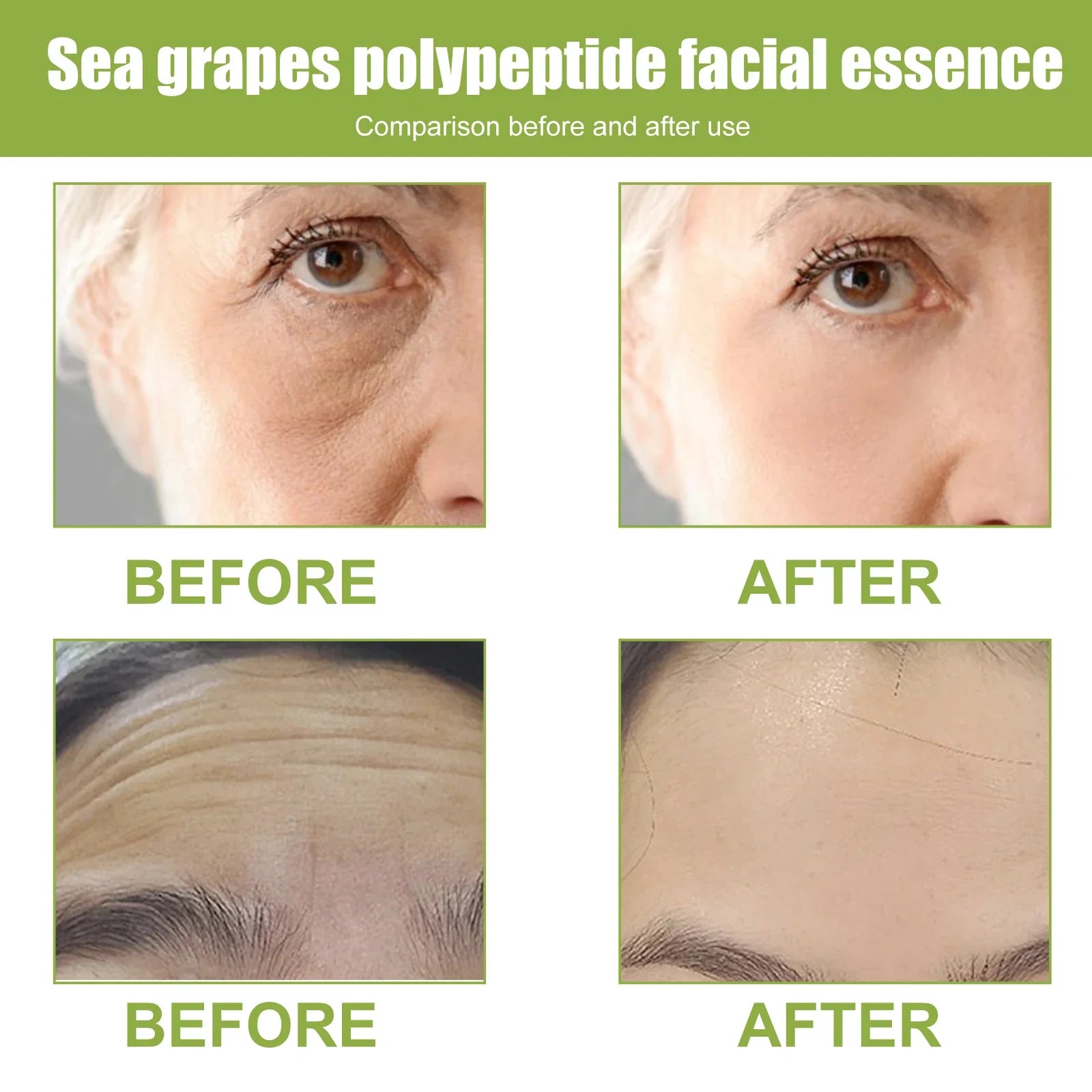 EELHOE Sea Grape Polypeptide Facial Essence Fade Fine Line Anti-wrinkle Firming Skin Lifting Moisturizing Booster Face Serum