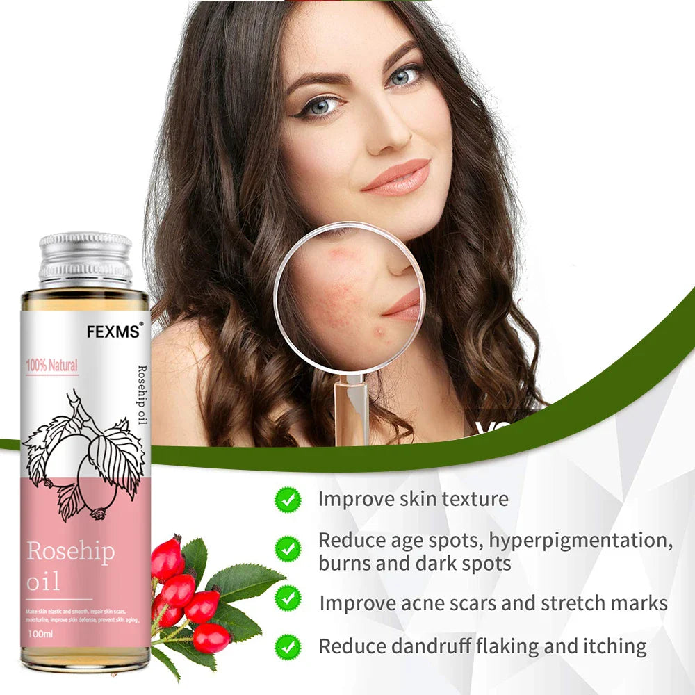 Rosehip Seed Oil, 100% Pure Organic Unrefined Cold Pressed Anti Aging Rose Hip Moisturizer For Hair Skin & Nails