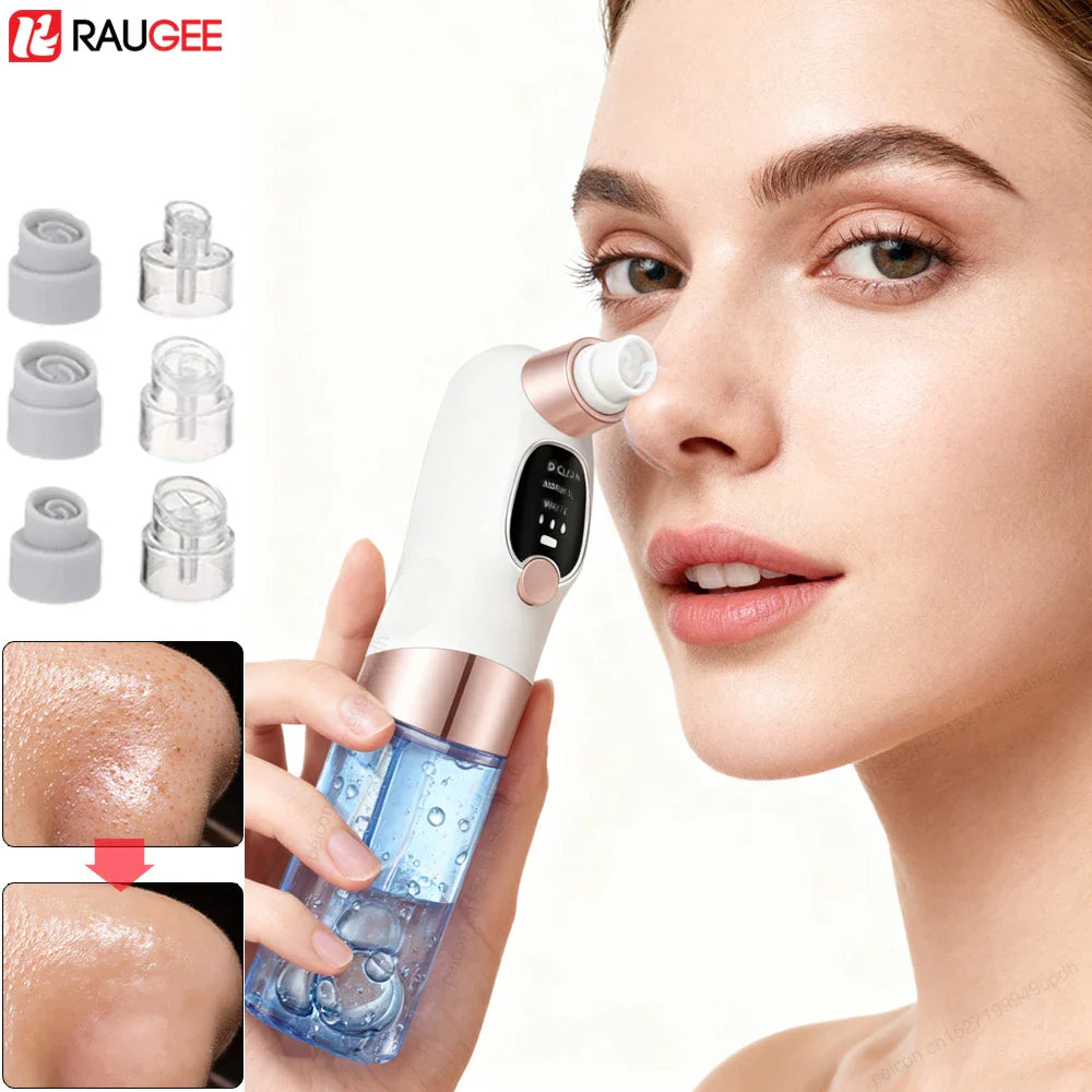Blackhead Remover Electric Black Head Remover Pore Vacuum Cleaner Micro Small Bubble Rechargeable Water Cycle Black Dot Remove
