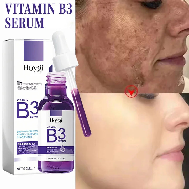 Hoygi Niacinamide Facial Serum Vitamin B3 Wrinkles Pigment Dark Spot Removal Correcting Glow Serum Face Whitening Moisturizer