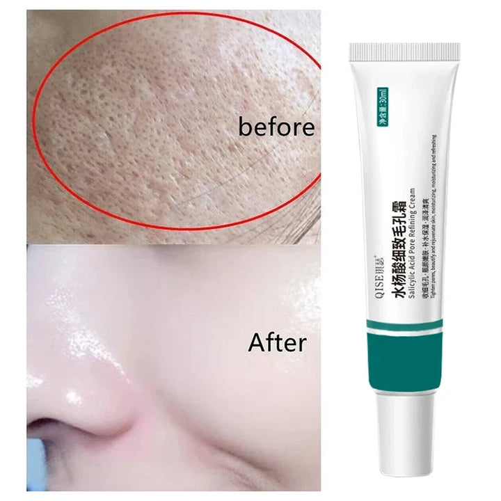 Hot Salicylic Acid Pore Shrinking Cream Quick Elimination Large Pores Remove Blackehead Tighten Face Smooth Skin Care Products