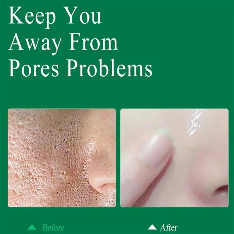 Hot Salicylic Acid Pore Shrinking Cream Quick Elimination Large Pores Remove Blackehead Tighten Face Smooth Skin Care Products