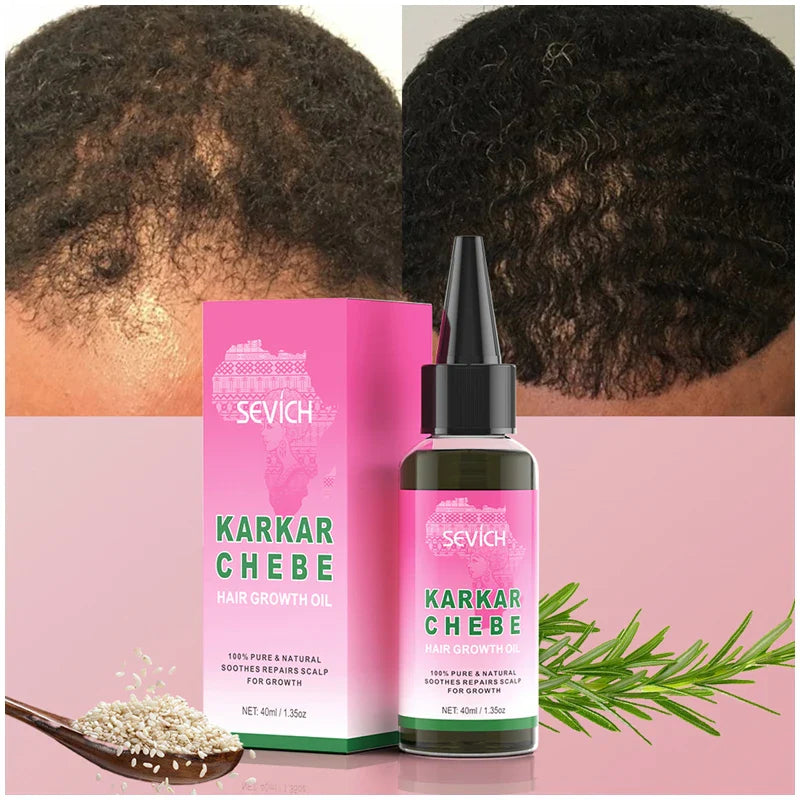 100% Pure Natural Karkar Chebe Oil Batana Butter Hair Growth Oil Rosemary Repair Damaged Hair Treatment Oil Anti-Hair Loss Care