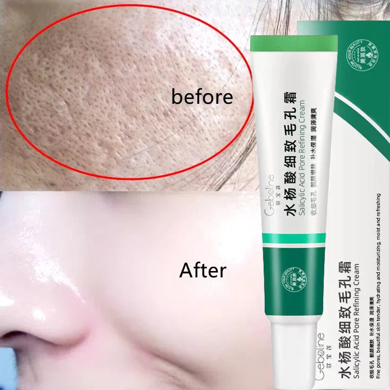 Salicylic Acid Pore Shrinking Cream Eliminate Large Pores Serum Remove Blackhead Acne Repairing Tightening Skin Care Cosmetics
