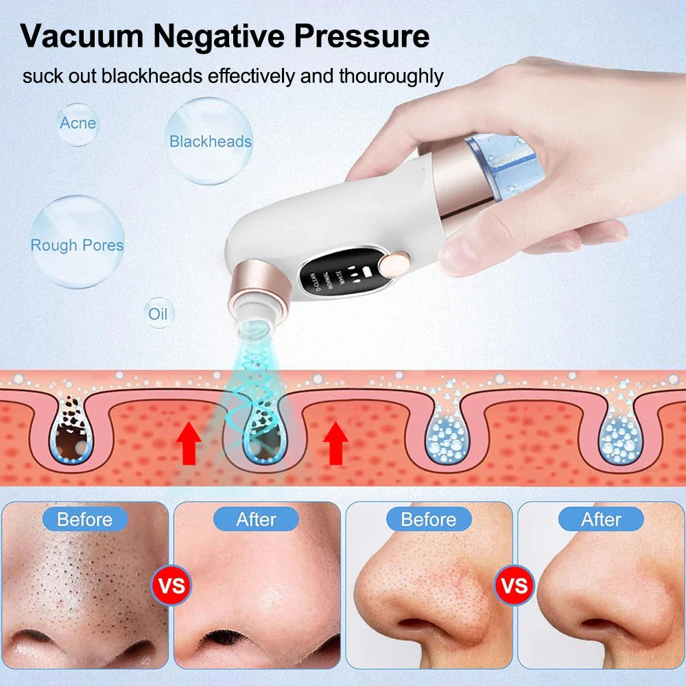 Blackhead Remover Electric Black Head Remover Pore Vacuum Cleaner Micro Small Bubble Rechargeable Water Cycle Black Dot Remove