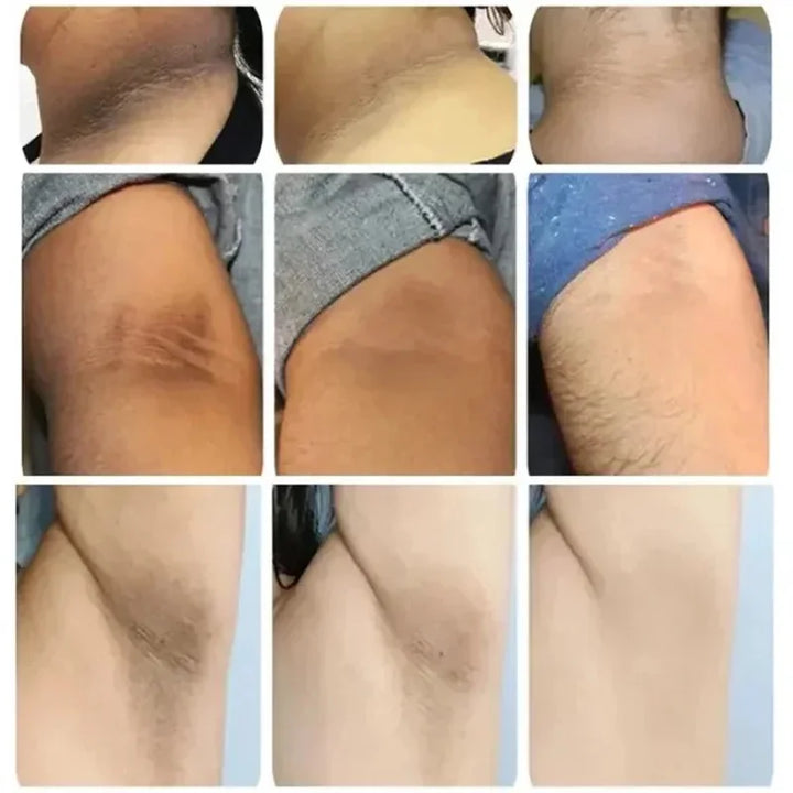 Brightening Cream For Intimate Parts Body Knees Remove Dull Pigments Brighten Serum Elbows Knuckles Lightening Skin Care Product