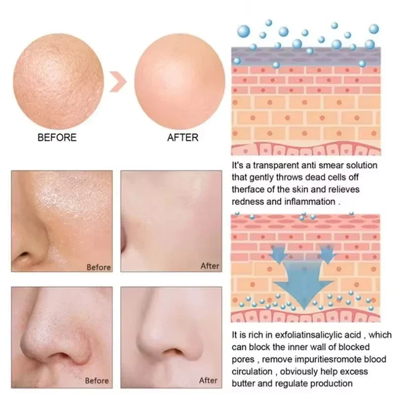 Remove Large Pores Serum Lactic Acid Facial Pore Shrinking Repairing Products Pore Minimizing Firming Smooth Korean Skin Care.