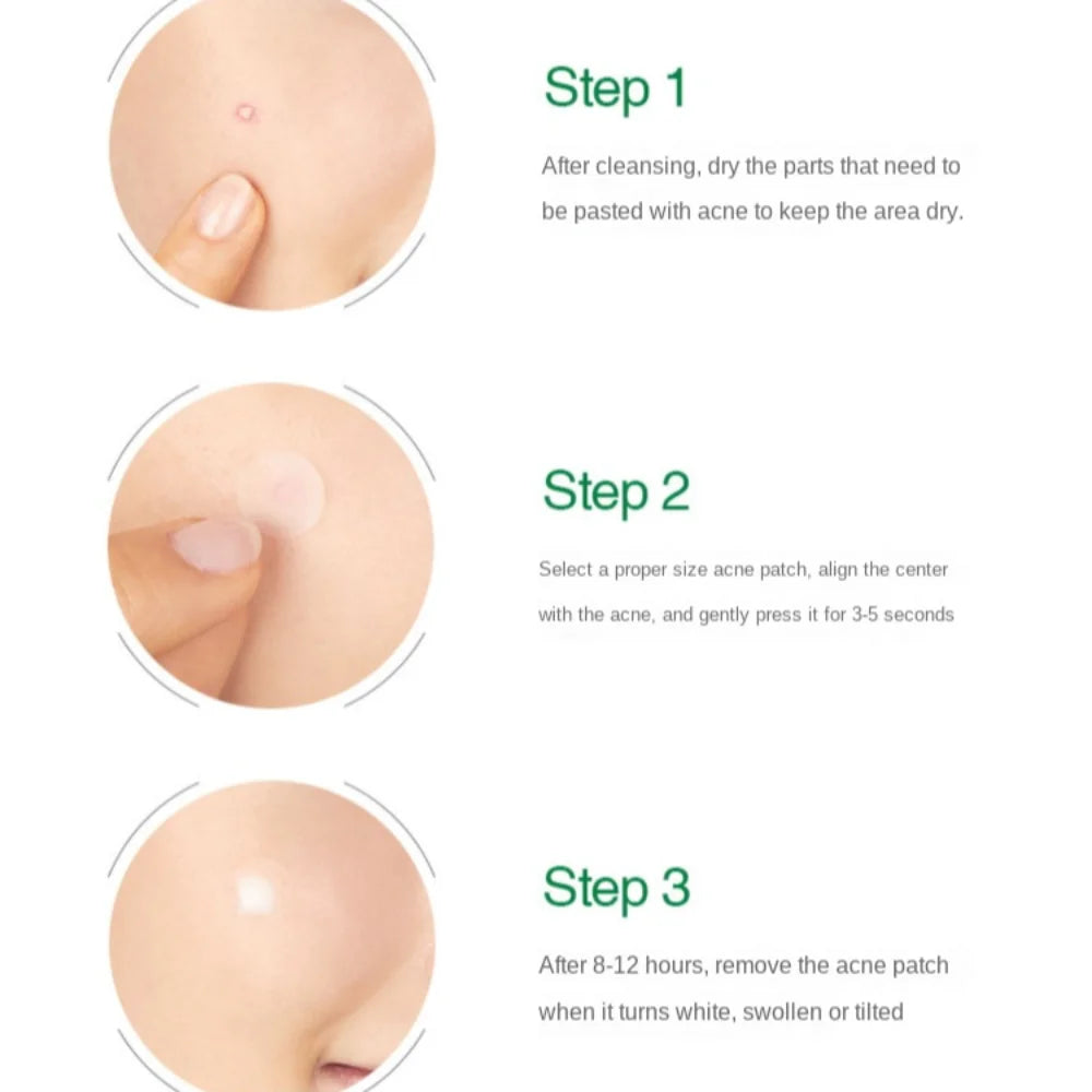 Skin Acne Removal Patch Invisible Beauty Stickers Pimple Patch Absorbing Liquid Transparent Acne Cleansing Patch Skin Care Tools