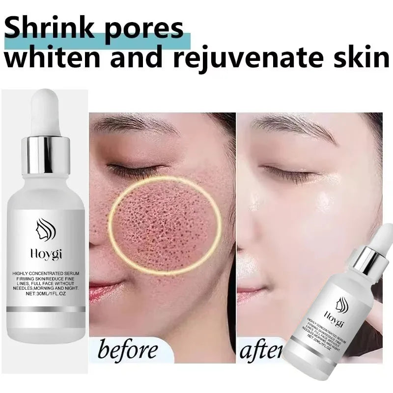 Remove Large Pores Serum Lactic Acid Facial Pore Shrinking Repairing Products Pore Minimizing Firming Smooth Korean Skin Care.