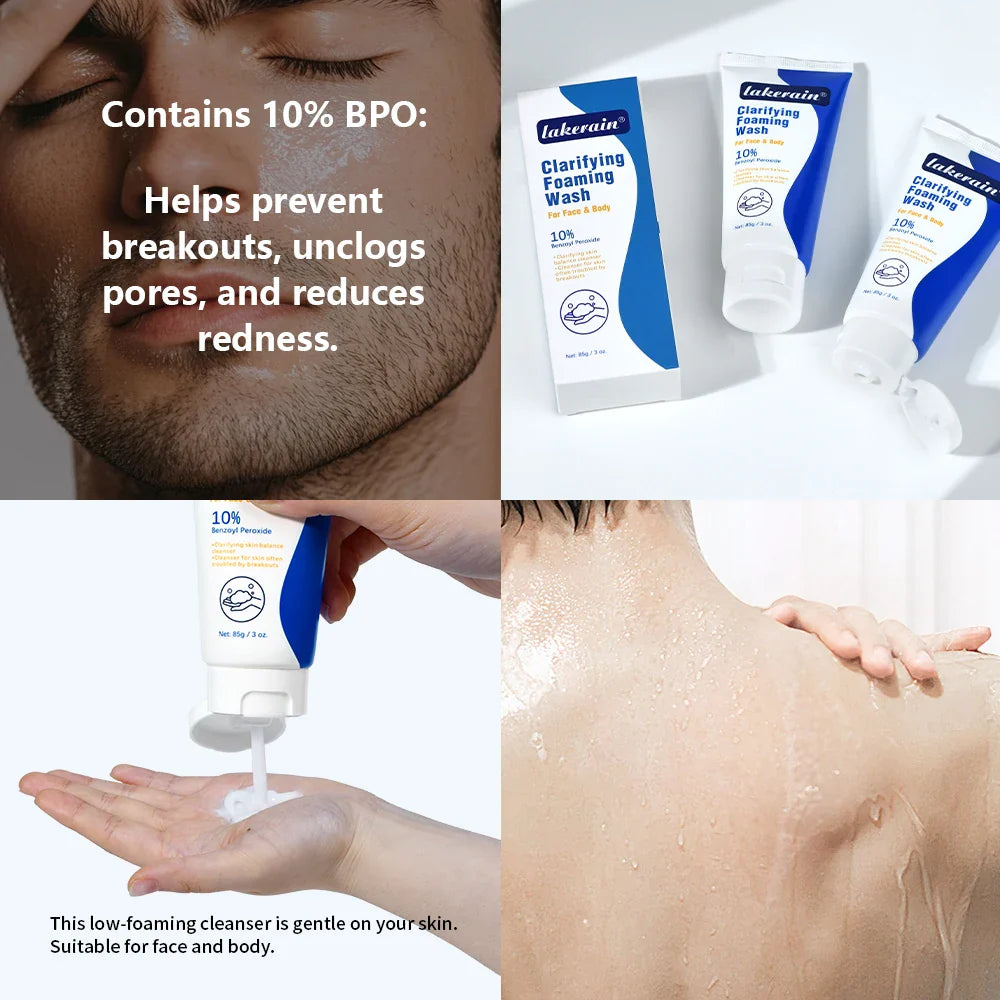 Acne Foaming Wash Deep Cleaning Unclogs Pores Prevents Breakouts for Face & Body Moisturizers Reduces Redness Skin Care