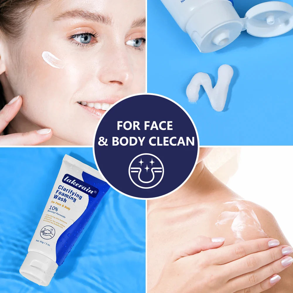 Acne Foaming Wash Deep Cleaning Unclogs Pores Prevents Breakouts for Face & Body Moisturizers Reduces Redness Skin Care