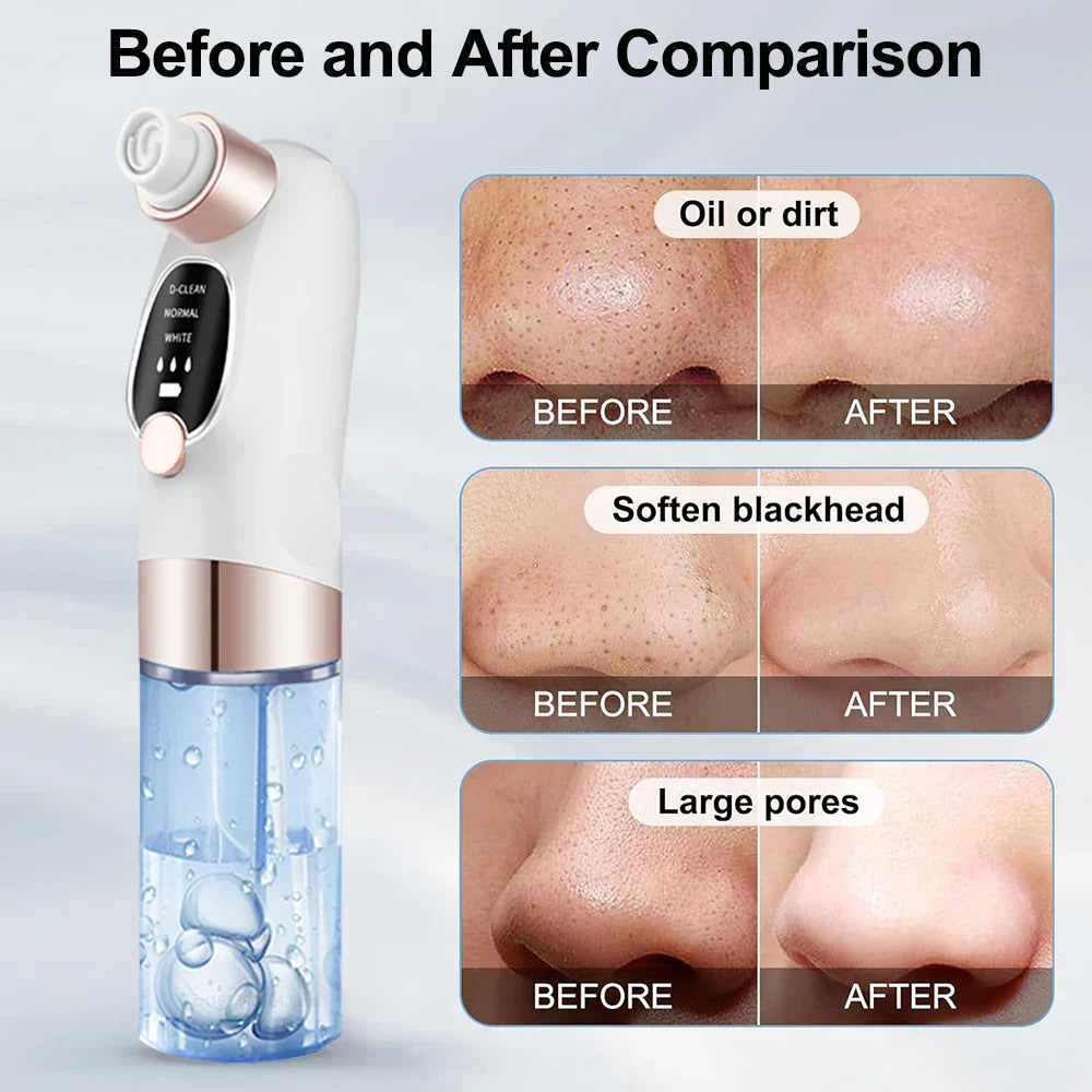 Blackhead Remover Electric Black Head Remover Pore Vacuum Cleaner Micro Small Bubble Rechargeable Water Cycle Black Dot Remove