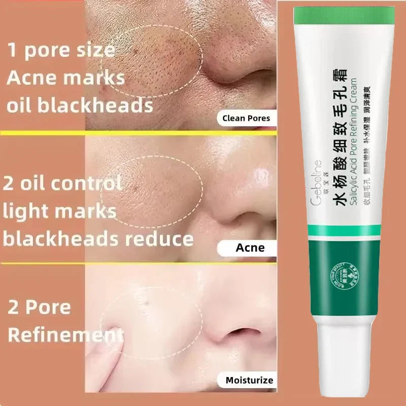 Salicylic Acid Pore Shrinking Cream Eliminate Large Pores Serum Remove Blackhead Acne Repairing Tightening Skin Care Cosmetics