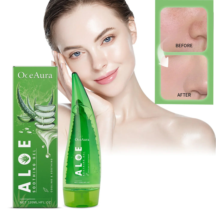 120ml Natural Organic Aloe Vera Gel Skin Lightening Moisturizing Tone Acne-removing Aloe Vera Gel After-sun Moisturizing Cream